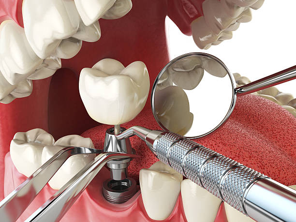Best Same-Day Emergency Dental Services in Pendergrass, GA